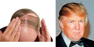  cure your baldness